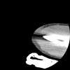 SPORK, NICO - 22.03.1976 - 02.08.2022 - CT obere Extremität - 17:51:17